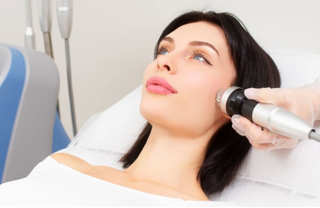 A woman receives RF microneedling treatment on her cheek with a specialized device, highlighting the deeper skin rejuvenation benefits compared to traditional microneedling.
